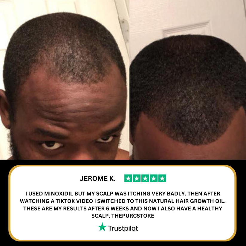 Purc Hair Revival Oil