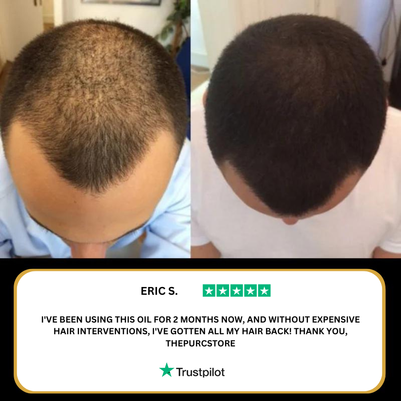 Purc Hair Revival Oil