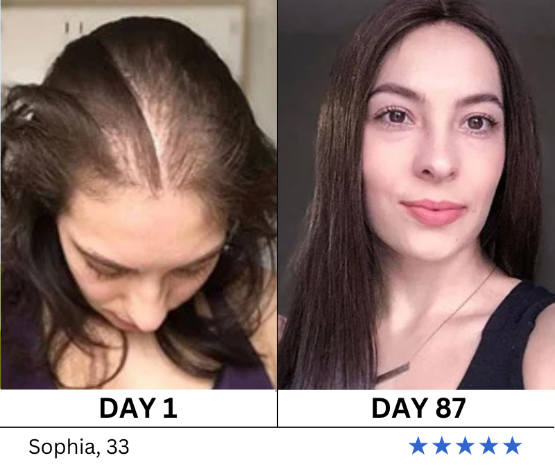 Vital Haven Hair Growth Serum