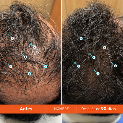 Revival | Shampoo de Alto Rendimiento para DENSIDAD Capilar