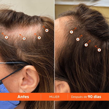 Revival | Shampoo de Alto Rendimiento para DENSIDAD Capilar