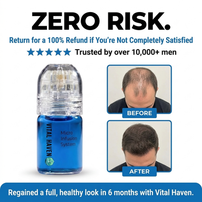 Revival Hair Regrowth Infusion™ System