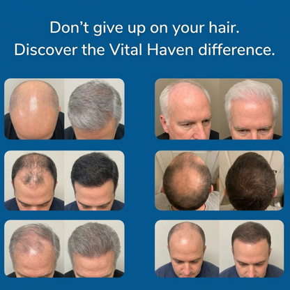 Revival Hair Regrowth Infusion™ System