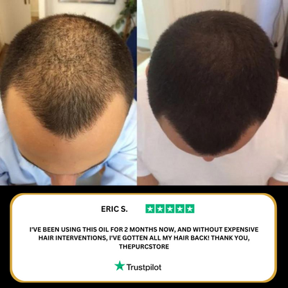 Purc Hair Revival Oil